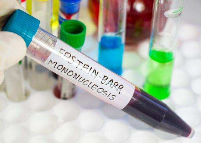 Muerte de una egresada: cómo se contrae la mononucleosis y qué habituales son los cuadros con complicaciones Muerte de una egresada: cómo se contrae la mononucleosis y qué habituales son los cuadros con complicaciones