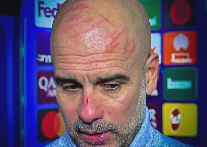 ¿Qué sucedió? Guardiola apareció con lesiones tras el empate del City tras ir ganando 3-0: su curiosa explicación. GdZEf-fXIAECs0n