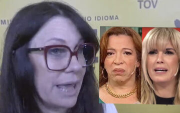 Cómo le quedó la cara a Camila Homs después de haber pasado una conjuntivitis viral grave