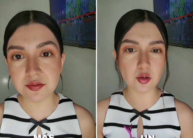 Le donó un riñón a su novio y al mes la dejó para casarse con otra