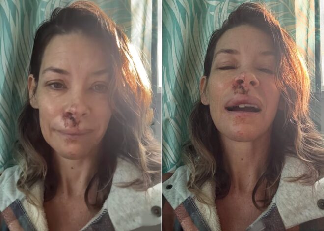 Evangeline Lilly, actriz de Lost, reveló que tiene daño cerebral tras un accidente en Hawái