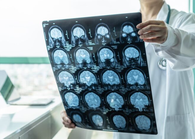 Un neurólogo explicó en detalle la relación entre los picos de glucosa y el Alzheimer Un neurólogo explicó en detalle la relación entre los picos de glucosa y el Alzheimer