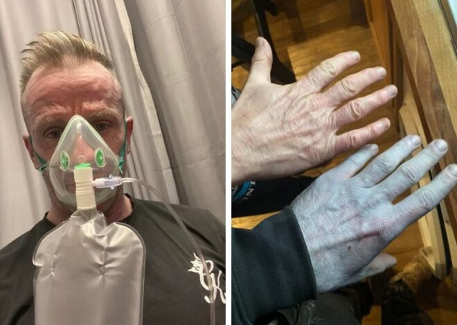Se despertó azul, fue a la guardia médica de urgencia y el diagnóstico que recibió lo dejó atónito